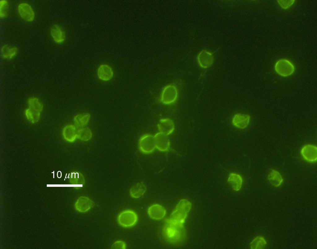 Cryptosporidium was a decisive factor for membrane filtration's expansion (especially UF)